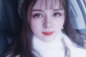 北京協(xié)和醫(yī)院整形外科價格？假體隆鼻術(shù)后恢復(fù)！