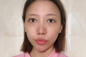 廣州善伊整形口碑如何？醫(yī)生名單+較新費(fèi)用表優(yōu)惠