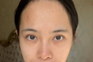 上海九院整形科植發(fā)？掛號(hào)難不難網(wǎng)上掛號(hào)攻略