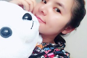 新橋醫(yī)院美容科隆鼻果如何？附術(shù)后圖+價(jià)格表