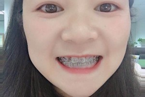 沈陽康貝佳口腔牙齒矯正怎么樣/醫(yī)生介紹+名單！