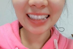 長沙市口腔醫(yī)院牙齒矯正多少錢？案例測(cè)評(píng)+價(jià)格表