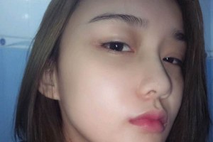 廣州軍區(qū)總醫(yī)院整形科好不好|下頜角手術(shù)日記&價(jià)格表