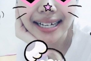 青島可恩口腔醫(yī)院牙齒矯正靠譜嗎？圖片對(duì)比+價(jià)格表