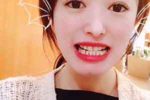 南京雅度口腔醫(yī)院怎么？術(shù)后反饋+醫(yī)生介紹