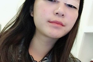 北京黃寺美容外科雙眼皮怎么樣?術(shù)后反饋+醫(yī)生介紹
