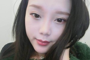 河南省人民醫(yī)院雙眼皮成功案例在線分享！
