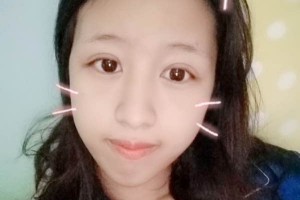 北京愉悅醫(yī)美雙眼皮口碑？醫(yī)院簡(jiǎn)介+案例