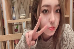 北京藝美醫(yī)療雙眼皮手術(shù)果如何？附2021價(jià)格表