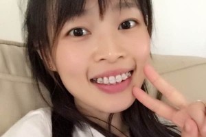 沈陽市口腔醫(yī)院牙齒矯正價(jià)格表&果圖