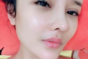 東莞光華醫(yī)院/鼻部手術(shù)成功案例和經(jīng)驗分享