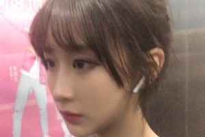 鄭州第一附院整形科靠譜嗎？下頜角真實(shí)案例圖