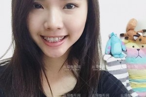 北京拜博口腔醫(yī)院靠譜嗎？附案例圖+價格表