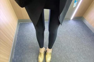 寧波六院整形科溶脂瘦身果如何？附案例圖速看！