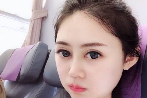 長(zhǎng)沙葉子下頜角整形價(jià)格表？醫(yī)院介紹+醫(yī)生名單！