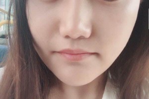 重慶原辰醫(yī)療美容醫(yī)院下頜角怎么樣？醫(yī)生信息介紹