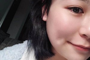 安醫(yī)二附院整形外科下頜角怎么樣？成功案例測(cè)評(píng)！