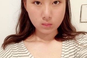 北京協(xié)和醫(yī)院整形外科下頜角醫(yī)生詳細(xì)介紹附價(jià)格表推薦！