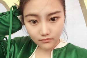 清大玉泉醫(yī)院下頜角正規(guī)嗎？術(shù)后日記分享！