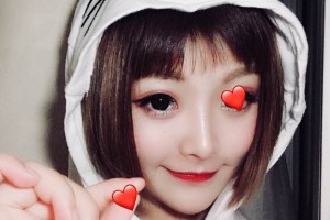 河南省人民醫(yī)院埋線雙眼皮/術(shù)前術(shù)后果對(duì)比！