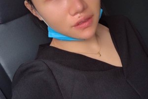 湘雅醫(yī)院皮膚激光中心哪位醫(yī)生好？眼部手術(shù)術(shù)前術(shù)后果對比！