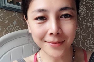 鄭州華領(lǐng)整形醫(yī)院硅膠隆鼻評(píng)價(jià)/術(shù)前術(shù)后果對(duì)比！