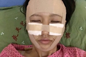 上海安縵醫(yī)療怎么樣？面部填充成功案例測評！