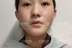 上海安縵醫(yī)療美容怎么樣？熱瑪吉反饋|醫(yī)生介紹