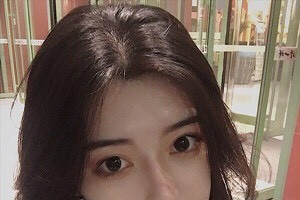 廈門(mén)新生毛發(fā)醫(yī)院是正規(guī)嗎？植發(fā)案例+醫(yī)院介紹