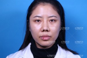 溫州附二醫(yī)激光美容科怎么樣？附案例圖+價(jià)格