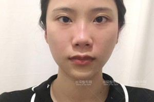 杭州浙一醫(yī)院有做熱瑪吉嗎？附果圖+價(jià)格表