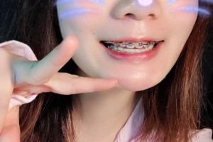 長(zhǎng)沙中諾口腔醫(yī)院/牙齒矯正圖片對(duì)比！