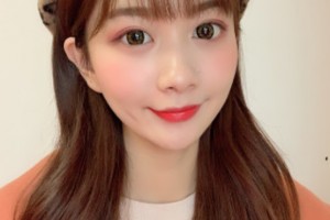 北京聯(lián)合麗格是三甲醫(yī)院?jiǎn)幔扛结t(yī)院介紹+雙眼皮果圖