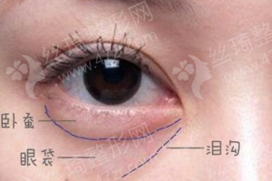 咸陽做射頻緊膚機(jī)構(gòu)排名射頻緊膚案例過程分享,射頻緊膚項(xiàng)目術(shù)后體驗(yàn)日記點(diǎn)評-醫(yī)院實(shí)力簡介