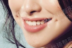 青島做牙齒種植機構排名牙齒種植醫(yī)生術后體驗過程點評!醫(yī)院優(yōu)勢簡介-醫(yī)院優(yōu)勢盤點