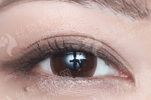 泰安做開眼角醫(yī)院排名開眼角項目術后體驗記錄點評,醫(yī)院優(yōu)勢介紹!醫(yī)院優(yōu)勢盤點