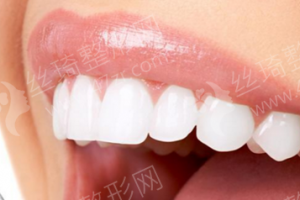 上海做牙齒美白機(jī)構(gòu)排名牙齒美白醫(yī)生術(shù)后案例細(xì)節(jié)點(diǎn)評(píng)|醫(yī)院信息|牙齒美白醫(yī)生術(shù)后案例細(xì)節(jié)點(diǎn)評(píng)