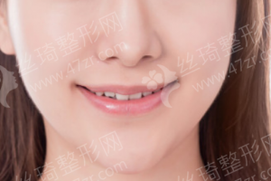 石家莊做牙齒拋光醫(yī)院排行榜醫(yī)院擅長(zhǎng)|醫(yī)院詳情,牙齒拋光醫(yī)生術(shù)后案例細(xì)節(jié)點(diǎn)評(píng)